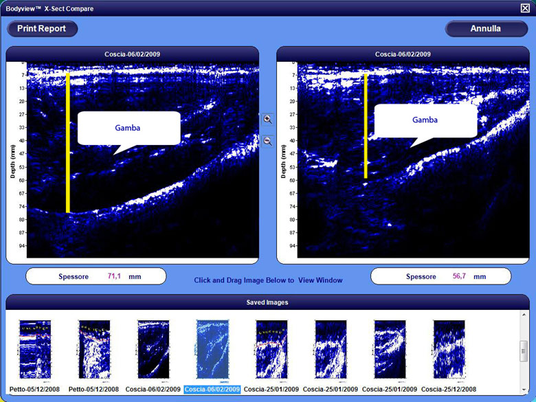 body-scan-2 body-scan-2